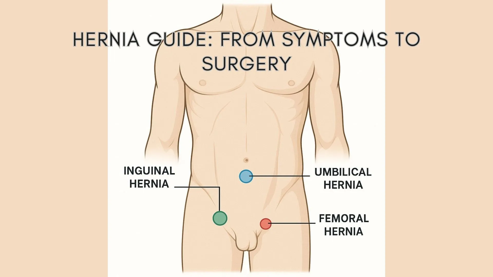 Life Elevated: Tips, Ideas & Products for Home and Health 1 Hernia